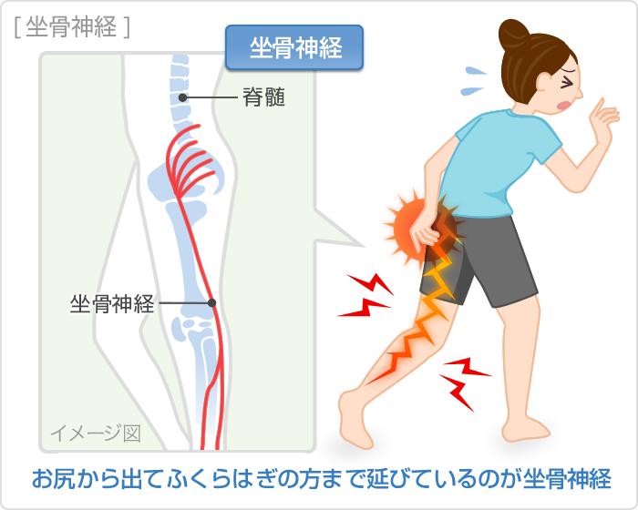 1ヵ月以上腰痛で２～3日前から激痛に！