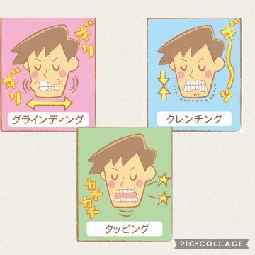 噛み締めが強い人は・・・