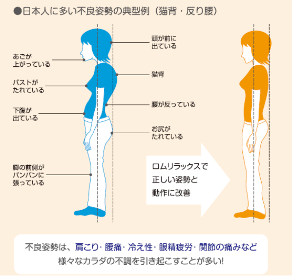 姿勢と背骨の歪みチェックの重要性
