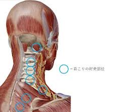 ストレスと首のコリ