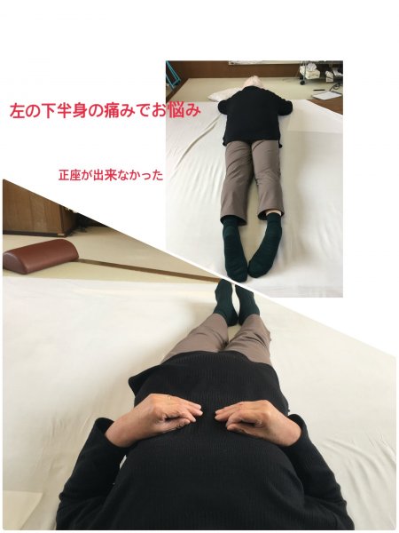 左下半身の痛み・・・真っ直ぐ寝ているつもりが　実は大きく曲がっていました
