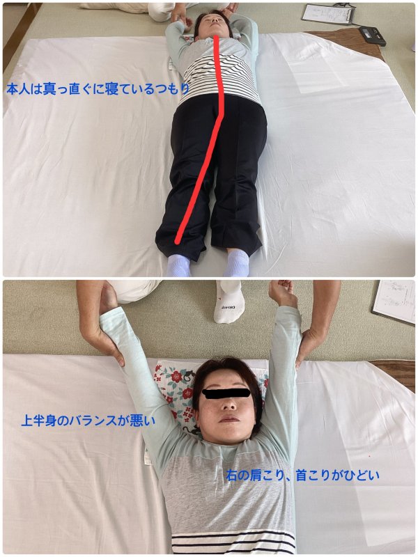 本人は真っすぐ寝ているつもり...でも上半身は大きく傾いていました