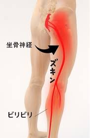 足のしびれ・痛みは体からの「通行止め」のサイン？